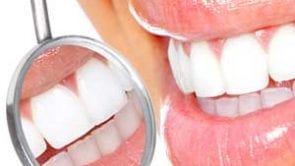 dentail cleaning in downtown los angeles dentist